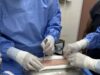 Realizan primer trasplante de piel con donante vivo en Hospital Juan Noé