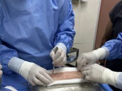 Realizan primer trasplante de piel con donante vivo en Hospital Juan Noé